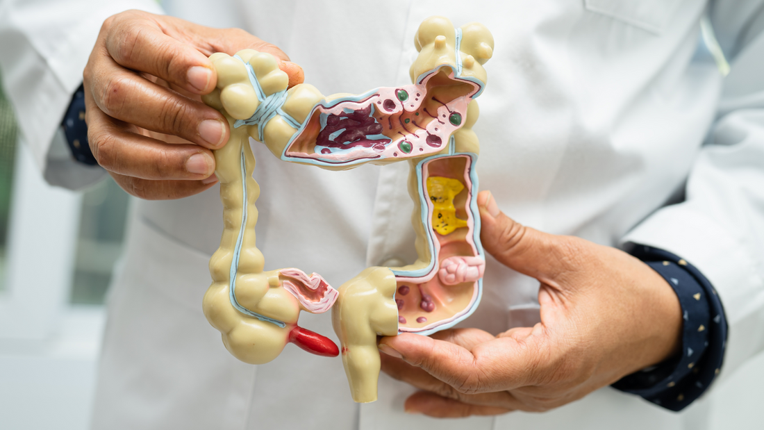 Why Probiotic + Prebiotic Supplements Are a Game-Changer for Gut Health